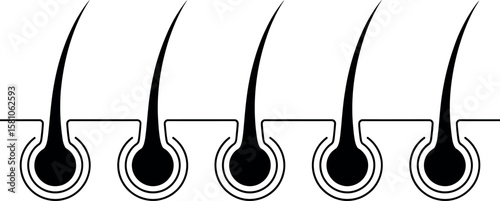 Hair follicle growth stages: five black vector illustrations.