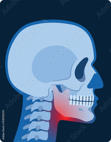 Jaw inflammation x-ray side view