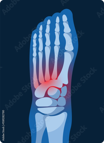 Foot joint inflammation x-ray vector illustration