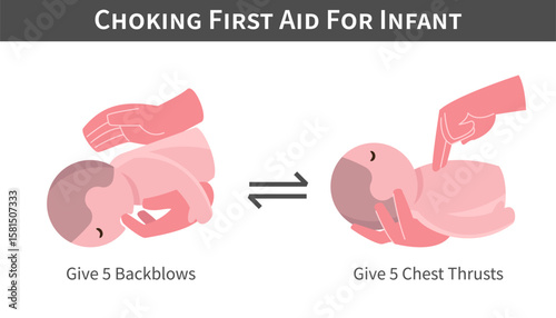 Choking First Aid For Infant cartoon illustration . Back blows and switch with chest thrusts . Flat design . Vector .