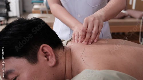Close-up shot of Oriental healing, Asian physiotherapist treats patient's back muscle pain relief by acupuncture hand procedure, passive medical therapy at healthcare wellness spa in hospital clinic.