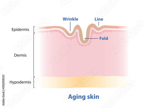 The line, wrinkle and fold on surface skin vector illustration. Cross section of aging skin that lose strength, flexibility and firmness on structure skin. Skin care and beauty concept. 