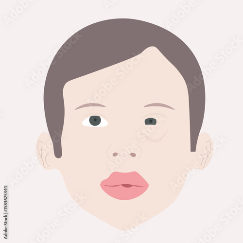 Flat vector illustrating anaphylaxis: swelling, rash, breathing trouble. Includes related allergies, asthma, and angioedema in clean, modern style. person
