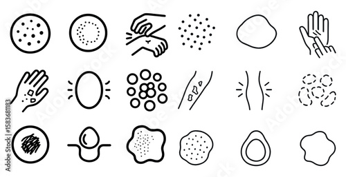 Series of images of various skin conditions, including acne, rashes, and bumps. The images are all in black and white and are arranged in a grid