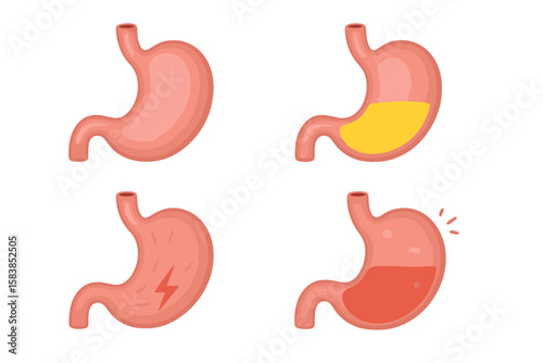 Human Stomach Vector Set. Digestive System Anatomy, Stomach Health and Disease. Empty, Full, Painful, Acidic Stomach. Nutrition, Gastric Pain, Internal Organ Care, Medical Illustration