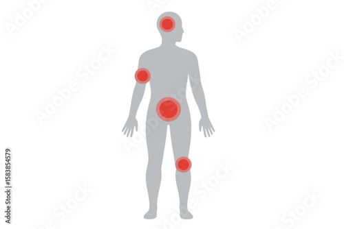 Pain localization chart with red circles on human body silhouette. Concept for headache, joint pain, muscular ache, stomachache. Medical vector illustration for health issues.
