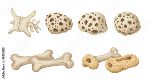 Illustration showing healthy bone and bone affected by osteoporosis with porous structures and shapes