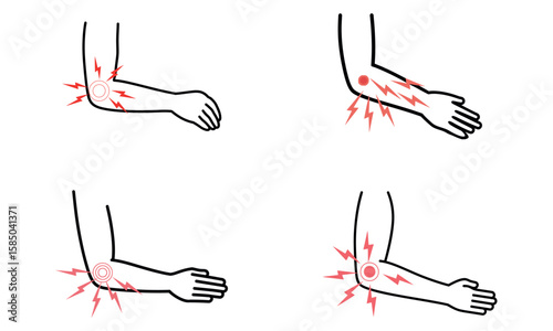 Elbow pain icon set showing red highlighted joint ache and arm discomfort symptoms
