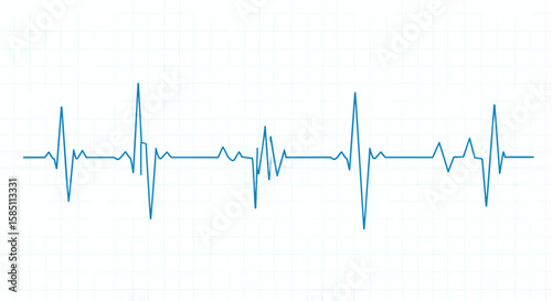 Heartbeat pulse line on graph paper background with blue ecg tracing