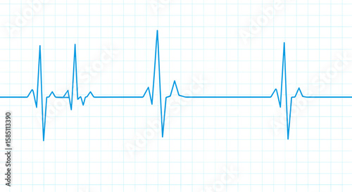 Minimalist blue heartbeat line on grid background