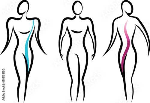 Stylized human figures showing spinal alignment and curvature body spine