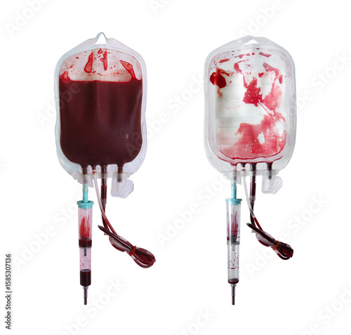 Blood bag during blood transfusion and after blood transfusion, Full and Empty Blood Bag isolated on white background