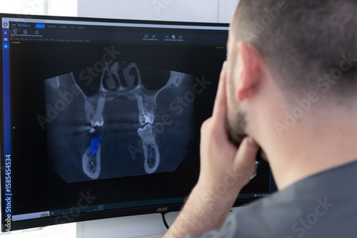 Dental Professional Analyzing 3D Cone Beam Computed Tomography Scan of Teeth and Jaw for Accurate Diagnosis and Treatment Planning in Modern Dentistry
