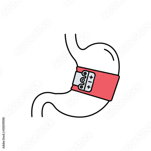 Adjustable gastric banding procedure for weight loss and appetite control