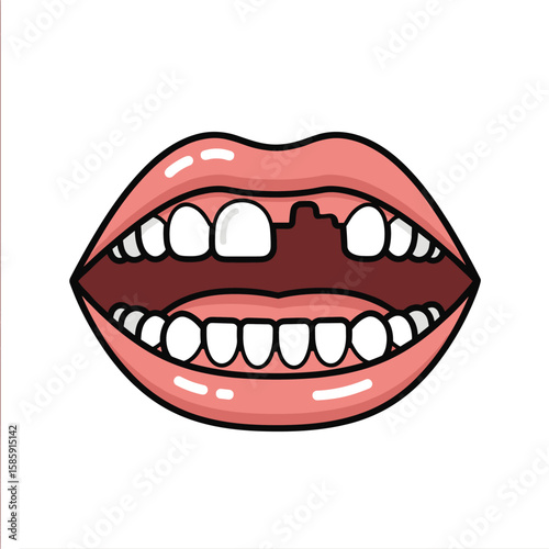 Understanding dentures and dental implants for missing teeth