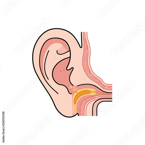 Understanding earwax buildup causes symptoms and effective home remedies for relief