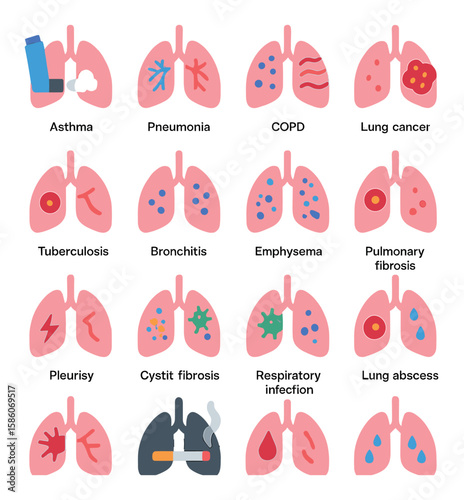 lung diseases and conditions modern flat style. asthma, pneumonia, COPD, lung cancer, tuberculosis, bronchitis, emphysema, pulmonary fibrosis, pleurisy, cystic fibrosis