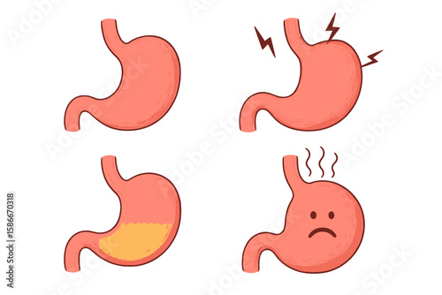 Human stomach anatomy icon set. Healthy vs unhealthy stomach problems. Pain, heartburn, acid reflux, gastritis, indigestion. Digestive system organ vector cartoon illustration.