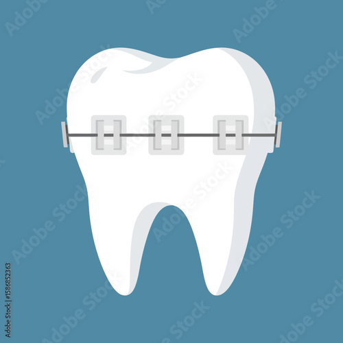 Tooth with braces on a blue background dental orthodontic treatment.