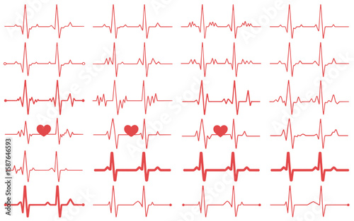 ECG Rhythm Icon Set – Silhouettes of Normal and Abnormal Heartbeat Patterns with Heart Symbols