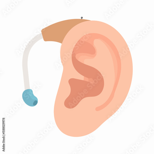 Illustration of a human ear with a hearing aid device attached, showing medical technology.
