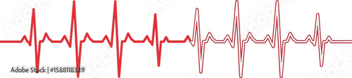 Bright red electrocardiogram showcases a heart rhythm pattern on a white grid