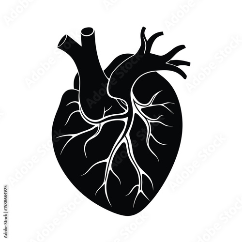Coronary Artery Blockage Medical Diagram