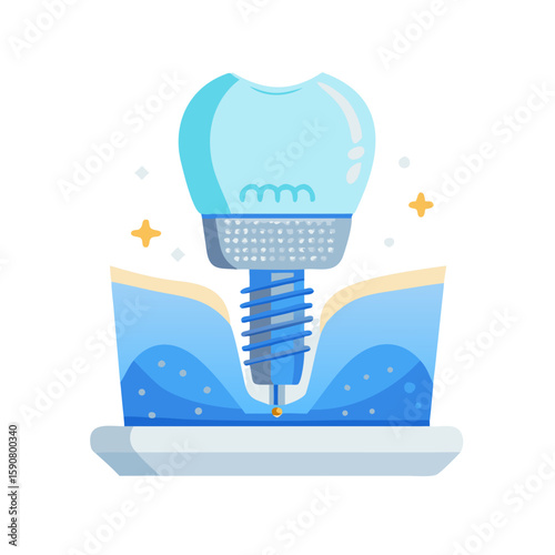 Dental implant placed in gum and jaw bone structure. Stomatology concept for tooth replacement. Vector icon for clinic, website, banner