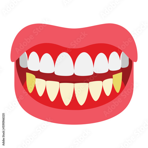 Smiling lips reveal healthy teeth with braces, a perfect dental care illustration.