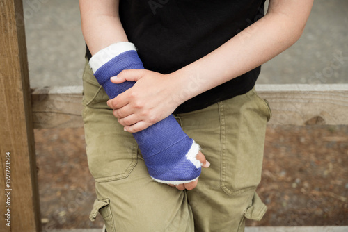 Plaster cast. Teenager's fractured arm, broken wrist bones