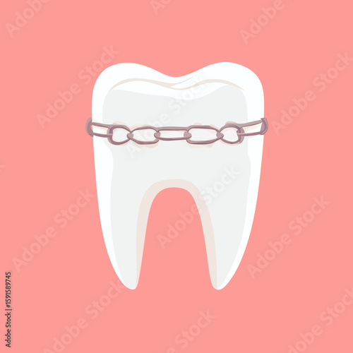Illustration of white tooth with metal braces wire orthodontic dental correction on pink background flat minimalist vector design