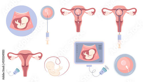 Set of infographic gynecological icons on natural and artificial insemination.  Fetal egg, sperm, uterus and ultrasound in vector style.