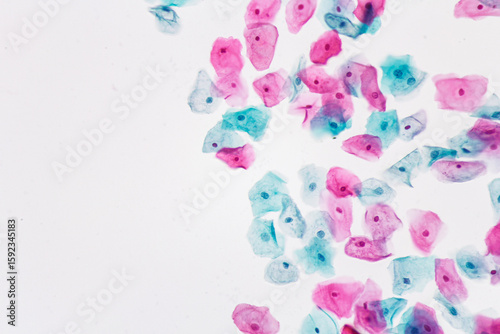 View in microscopic of normal human cervix cells.Squamous epithelial cells from pap smear cervixl and vaginal woman.Cervical cancer screening test.