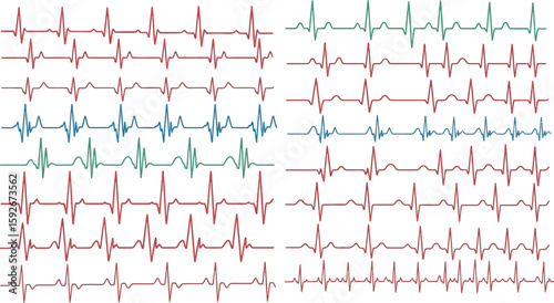 Illustration of multiple rows of colorful electrocardiogram heart beat waveforms on a white background