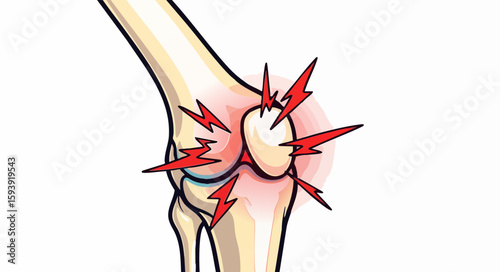 Knee joint pain illustration, medical diagram, red and beige colors, for healthcare publications