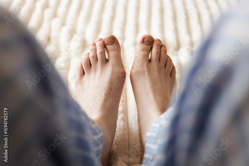 Photos Close-up of female feet with bunions resting on bed at home, Hallux valgus