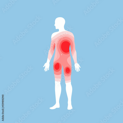 Human silhouette with highlighted areas of contact dermatitis condition  