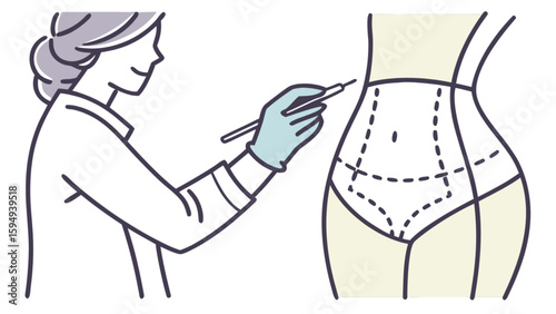 Plastic surgery consultation for liposuction tummy tuck procedure and body contouring preparation drawing lines