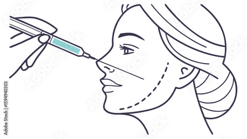 Nose filler injection procedure for facial contouring and aesthetic enhancement treatment at cosmetic clinic 100