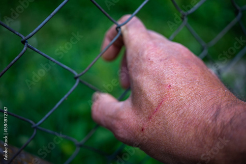 Caucasian man with wounded hand holding the wired fence at the correctional institute.