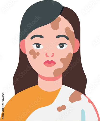 Understanding Vitiligo: A Visual Guide to Skin Pigmentation