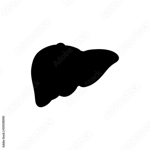 Liver Cirrhosis with Nodular Surface Illustration