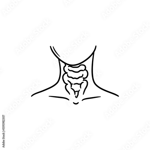 Goiter with Enlarged Neck for Thyroid Disease Illustration