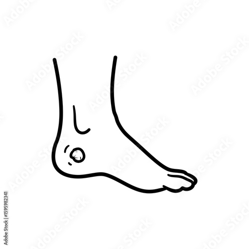Diabetic Foot Ulcer Icon for Diabetes-Related Health Conditions