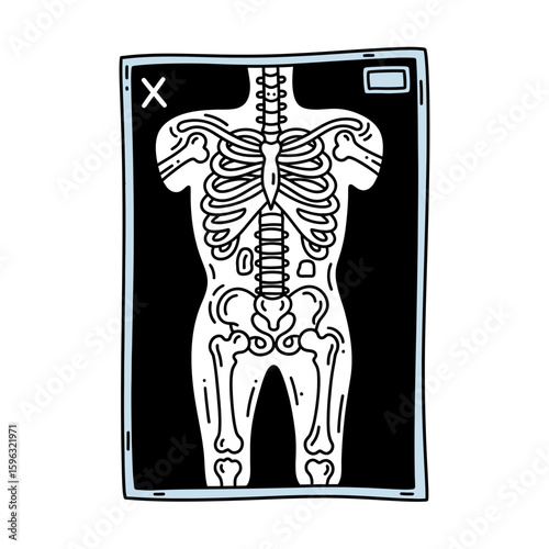 X-ray image of human skeleton shown on medical film  