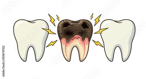 Cartoon teeth showcasing healthy and decayed conditions with pain indicators