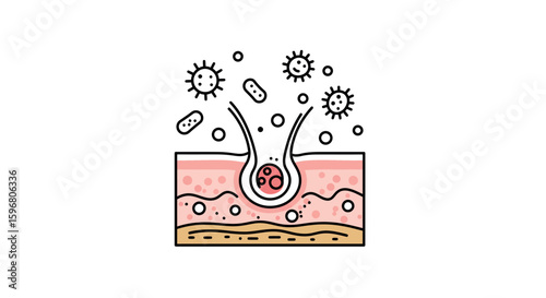 Skin and hair follicle with bacteria and acne in outline style