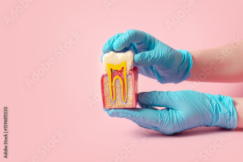 Dental 3D model of the dental cavity of the mouth in section. On the model there is a healthy tooth. Creative concept on a pastel background
