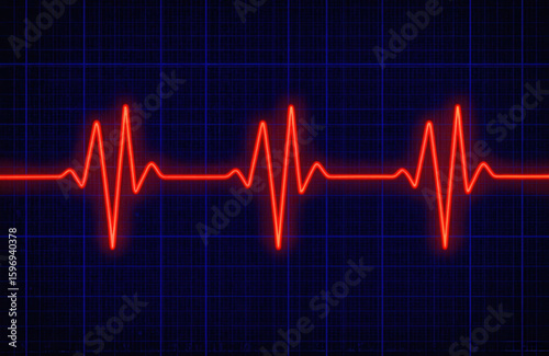 EKG readout displays irregular heartbeat during potential heart attack. Red glowing line on blue grid monitors vital signs in intensive care unit. Cardiology data shows arrhythmia, indicating