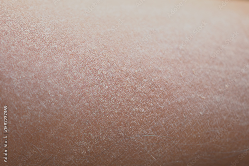 Fototapeta premium Dry Skin texture close-up showing natural details and patterns